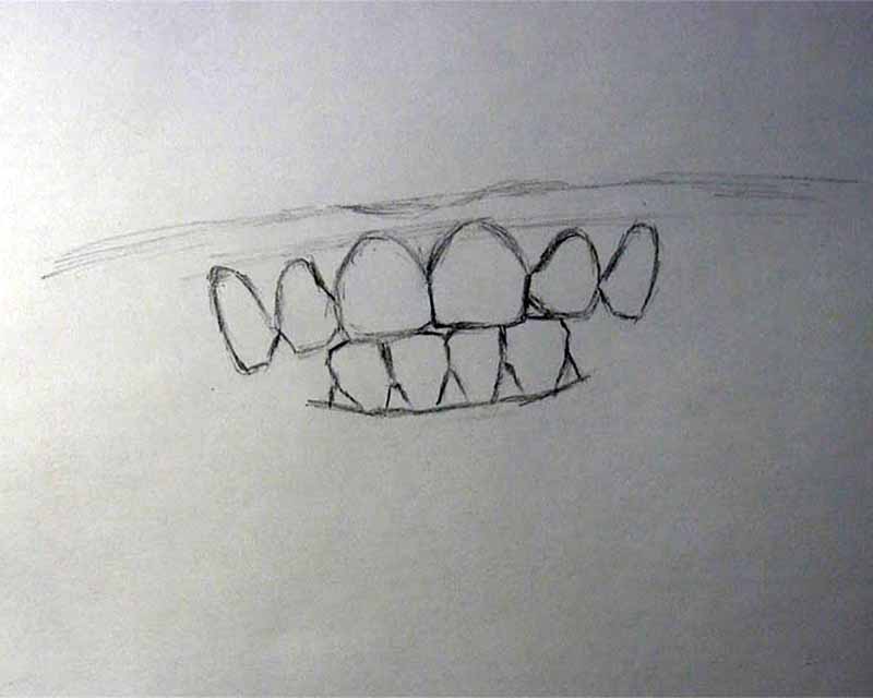 sketch remaining incisors